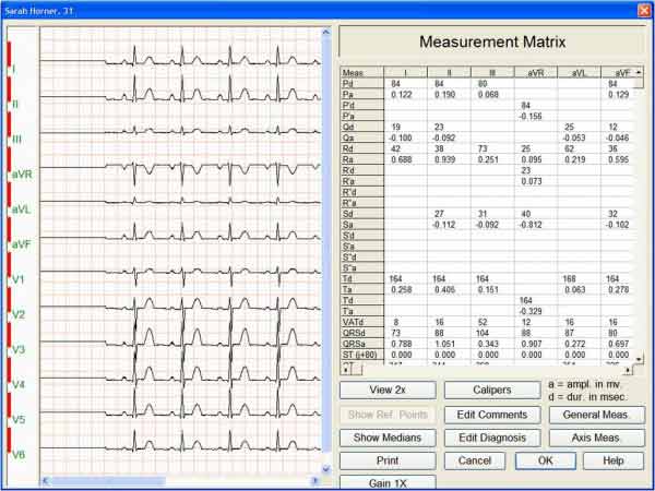 CGM Aprima