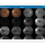Eyefinity EHR