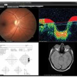 EyeMD EMR