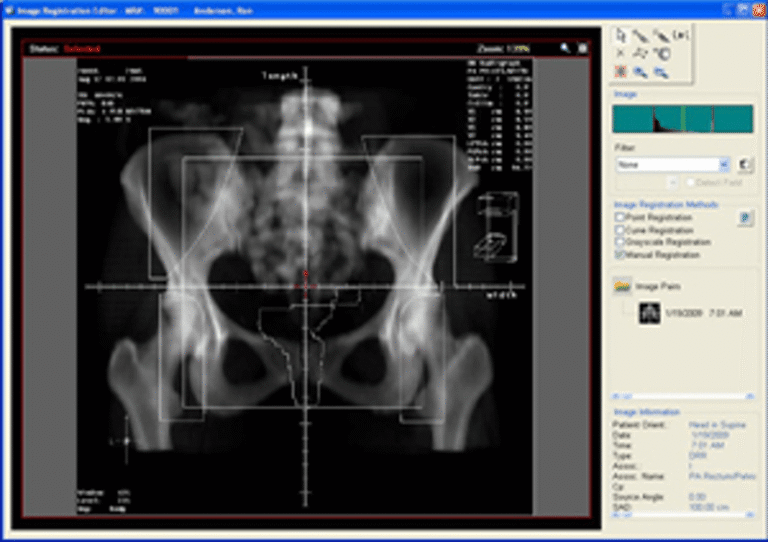 MOSAIQ EMR