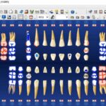 Dentrix