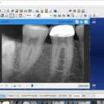 Dentrix