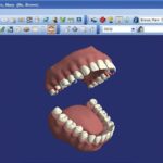 Dentrix