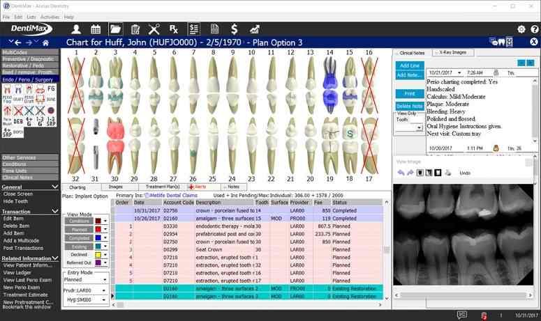 DentiMax