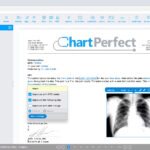 ChartPerfect
